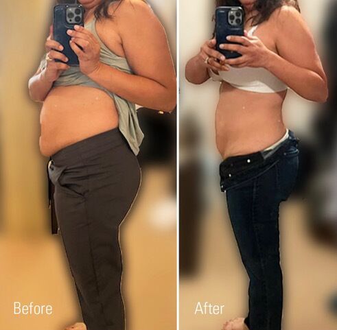 glp-1 weight loss glendale SKINNY Shot Weight Loss in Glendale AZ