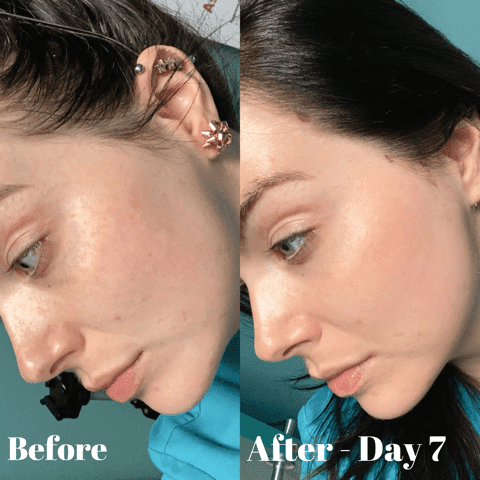 glutathione glendale Earthbar - Equinox - Cymbiotika Glutathione 1500mg Vial - Phoenix