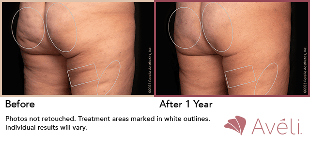 semaglutide tupelo ms MS Attorney General warns Mississippians of the dangers of unapproved  weight loss medication